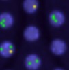 SFRT dose distribution for animal and cell experiments